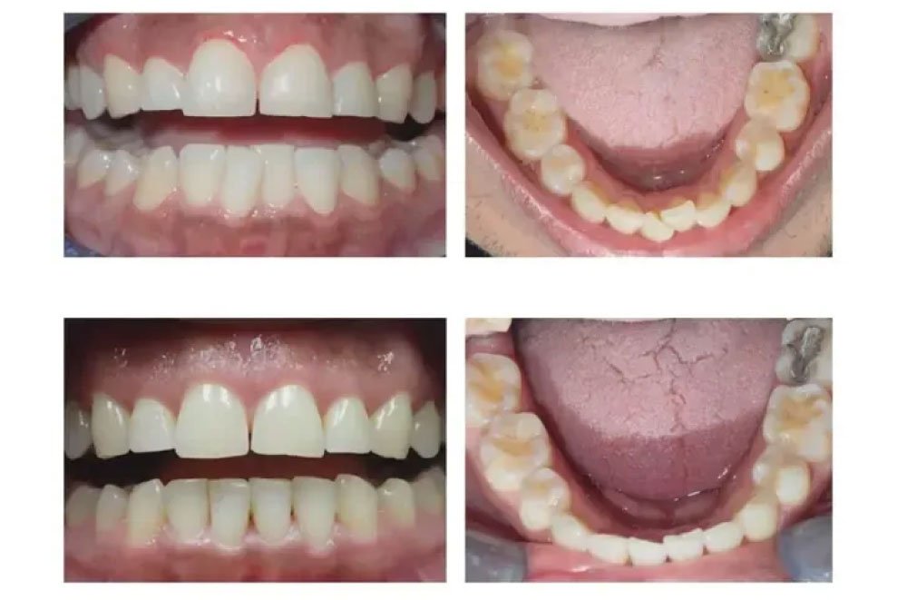Maple Valley Dentist Office