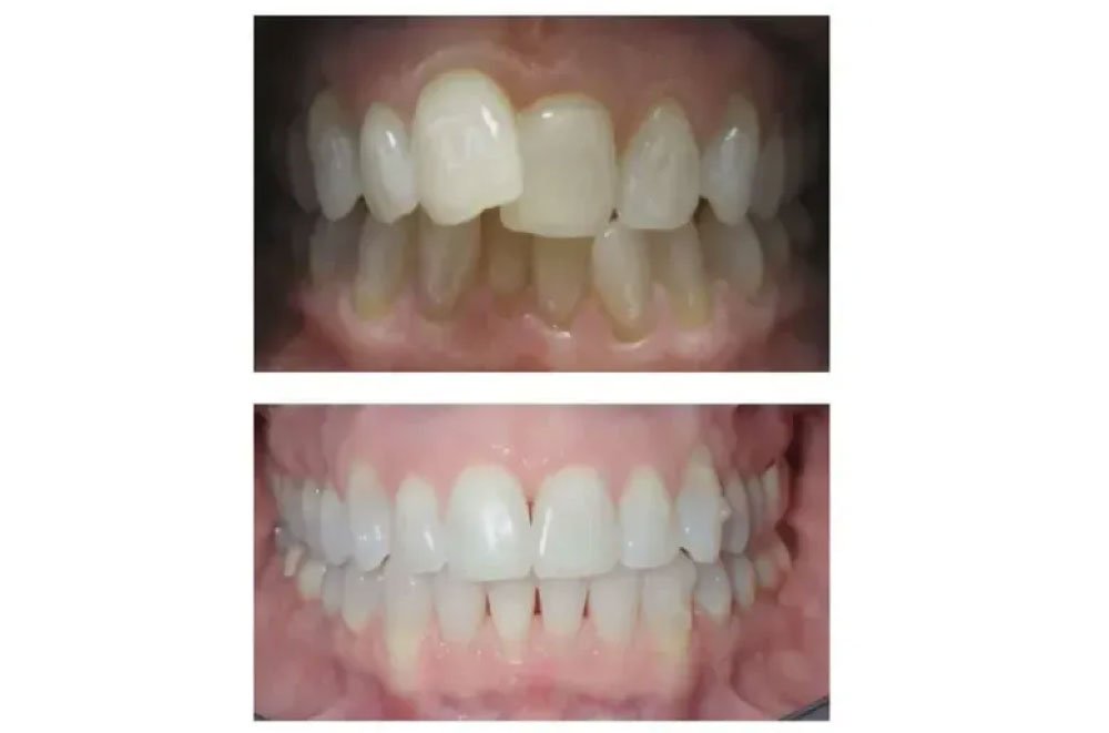 Maple Valley Dentist Office