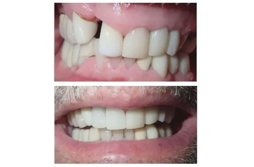 Maple Valley Dentist Office