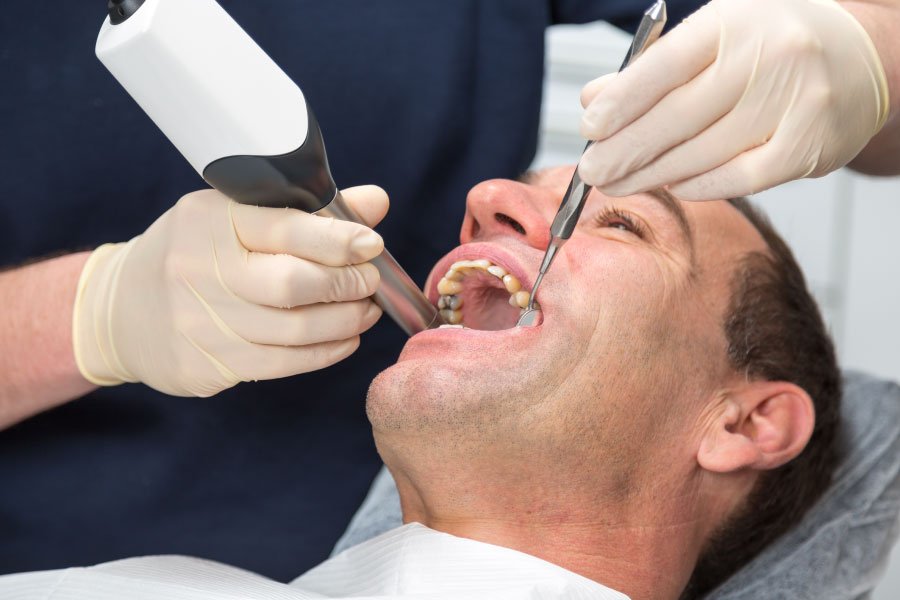 Maple Valley CEREC Crowns